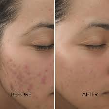 Face Serum Vitamin C & E