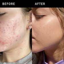 Face Serum Vitamin C & E