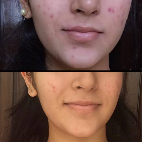 Face Serum  Vitamin C & E