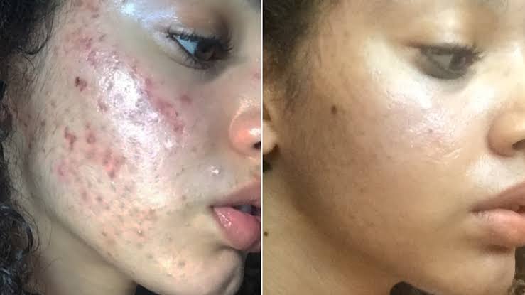 Face Serum Vitamin C & E