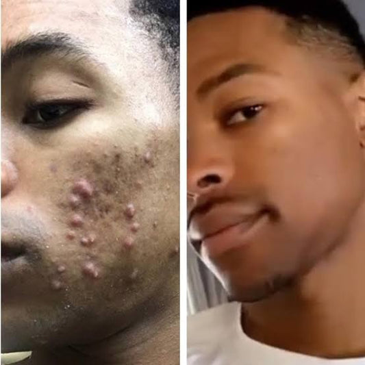 Face Serum  Vitamin C & E