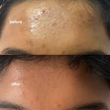 Face Serum  Vitamin C & E