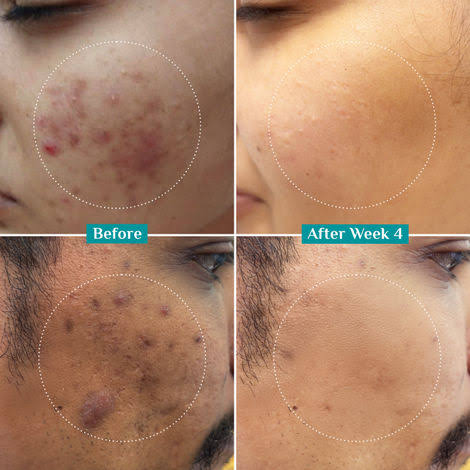Face Serum  Vitamin C & E