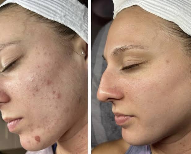 Face Serum  Vitamin C & E
