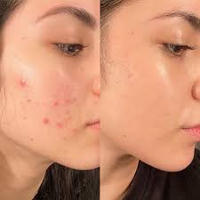Face Serum  Vitamin C & E