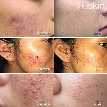 Face Serum  Vitamin C & E
