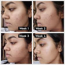 Face Serum  Vitamin C & E